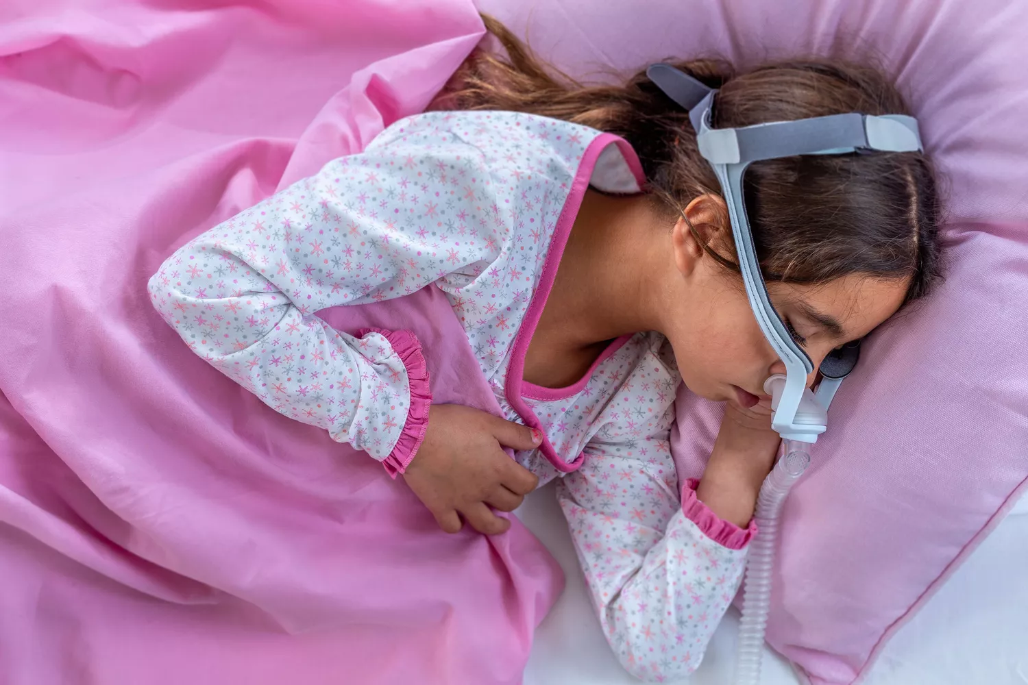 A young girl sleeping in bed wearing a pediatric CPAP mask with tubing connected to a device.