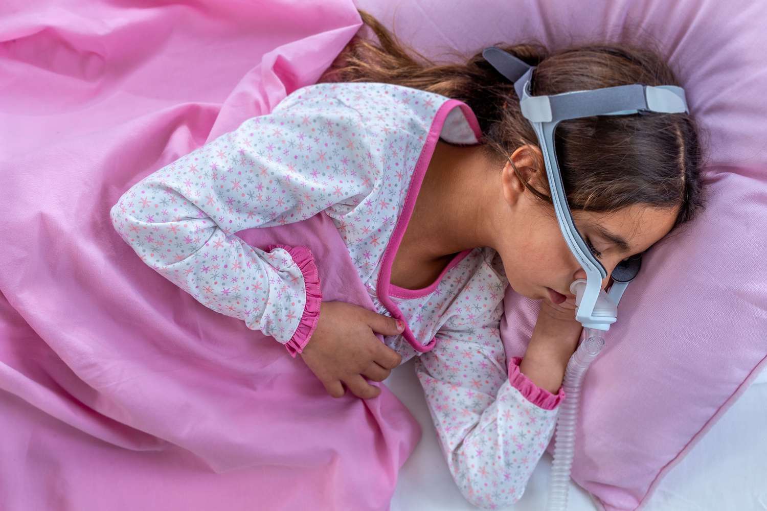 A young girl in pink pajamas sleeping while wearing a CPAP mask designed for pediatric use.
